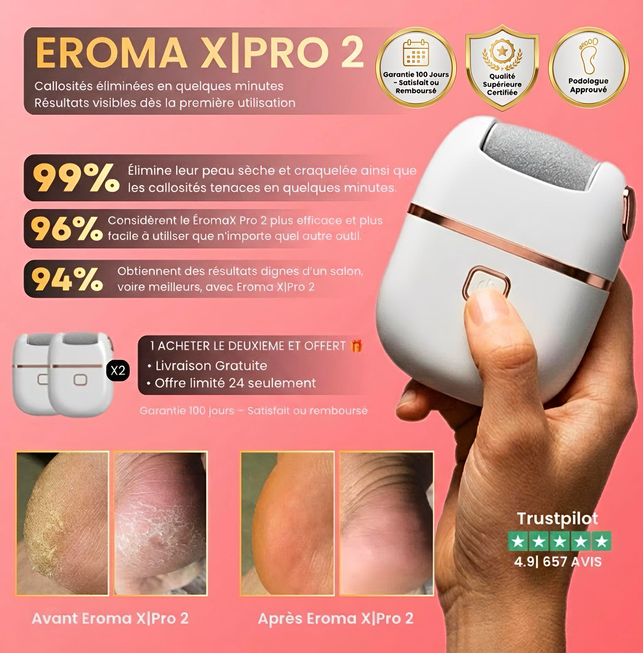 Appareil électrique anti-callosités main tenant râpe pédicure, photos avant après, résultats pieds lisses